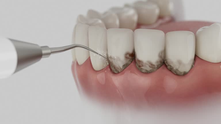 Trusted Teeth Cleaning And Checkup service in Minor, AL - Dentist Open Now